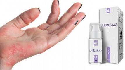 UNIDERMA (Унідерма) - гель від шкірних захворювань