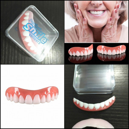 Perfect Smile Veneers - засіб для відбілювання зубів