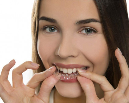 SMILE STAR (Смайл Стар) - комплексное лечение зубов